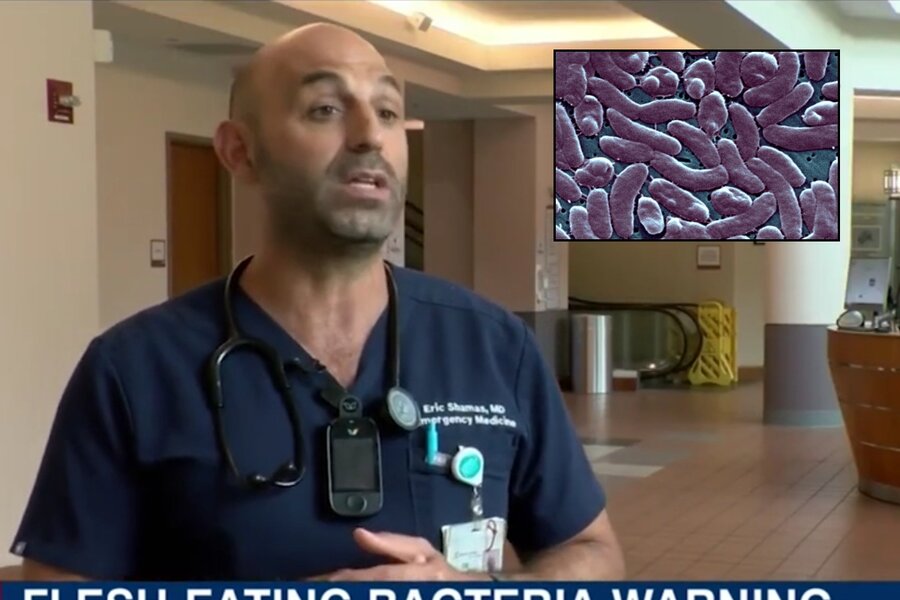 Florida Officials Confirm 5 Deaths From FleshEating Bacteria in Tampa