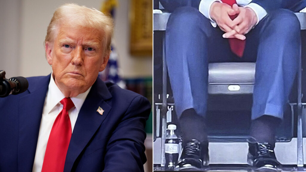 White House Reveals Medical Condition Causing Swelling in Trump’s Legs