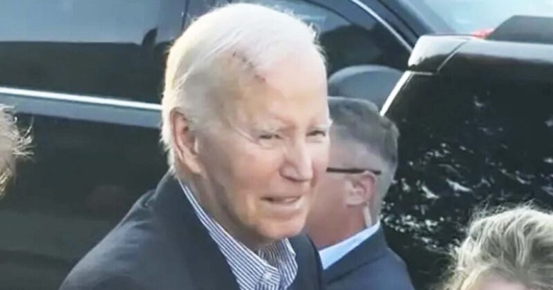 Joe Biden Undergoes Surgery to Remove Skin Cancer on Forehead